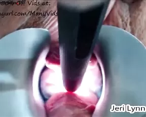 Jerilynn speculum show