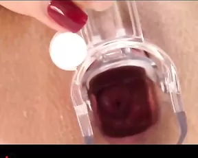 Caylin. speculum part.1